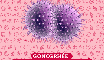 Gonorrhée : la « chaude-pisse » qui fait des ravages